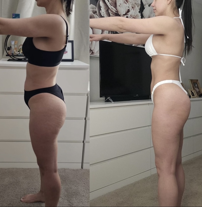 Antes e Depois 5
